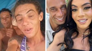Casal que vive há anos nas ruas ganha um novo sorriso em clínica de Santa Bárbara