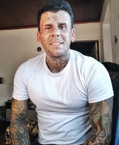 Homem mais tatuado do Brasil surpreende ao remover tatuagens e mudar visual
