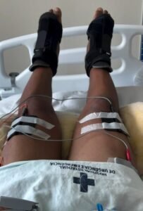 Mais um paciente volta a mexer as pernas após uso de polilaminina