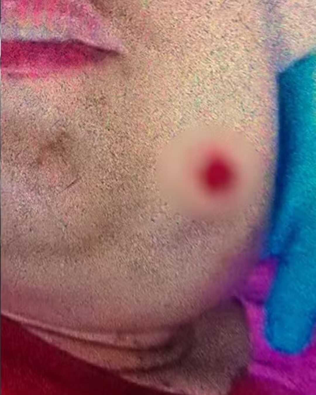 Jovem autista leva tiro no rosto após sorrir para homem