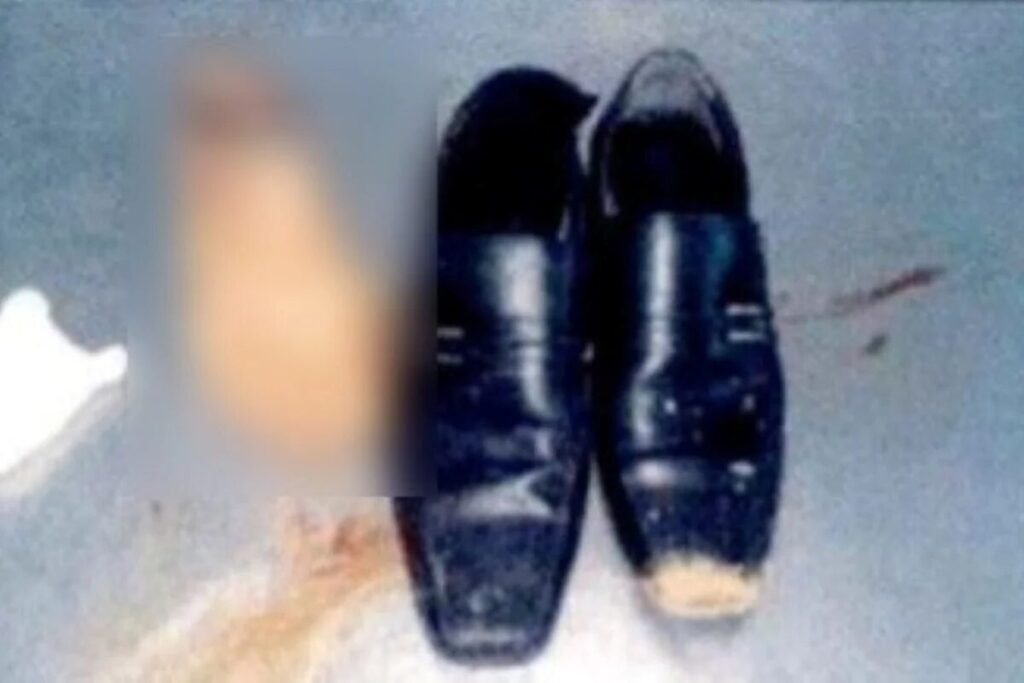 Homem que amputou o próprio pé para tentar receber R$ 1,5 milhão em seguro acaba preso