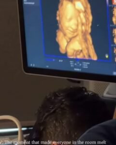 Bebê sorri ao ouvir a voz do pai durante ultrassom 3D e vídeo emociona milhões nas redes sociais