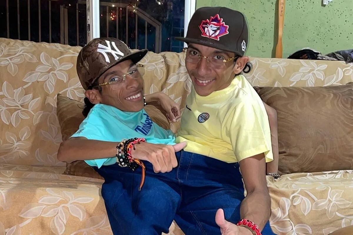 Famosos gêmeos siameses do Equador morrem aos 27 anos de idade